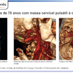 cirurgiao-vascular-dr-daniel-benitti-Folha-Vascular-163