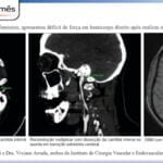cirurgiao-vascular-dr-daniel-benitti-Folha-Vascular-164